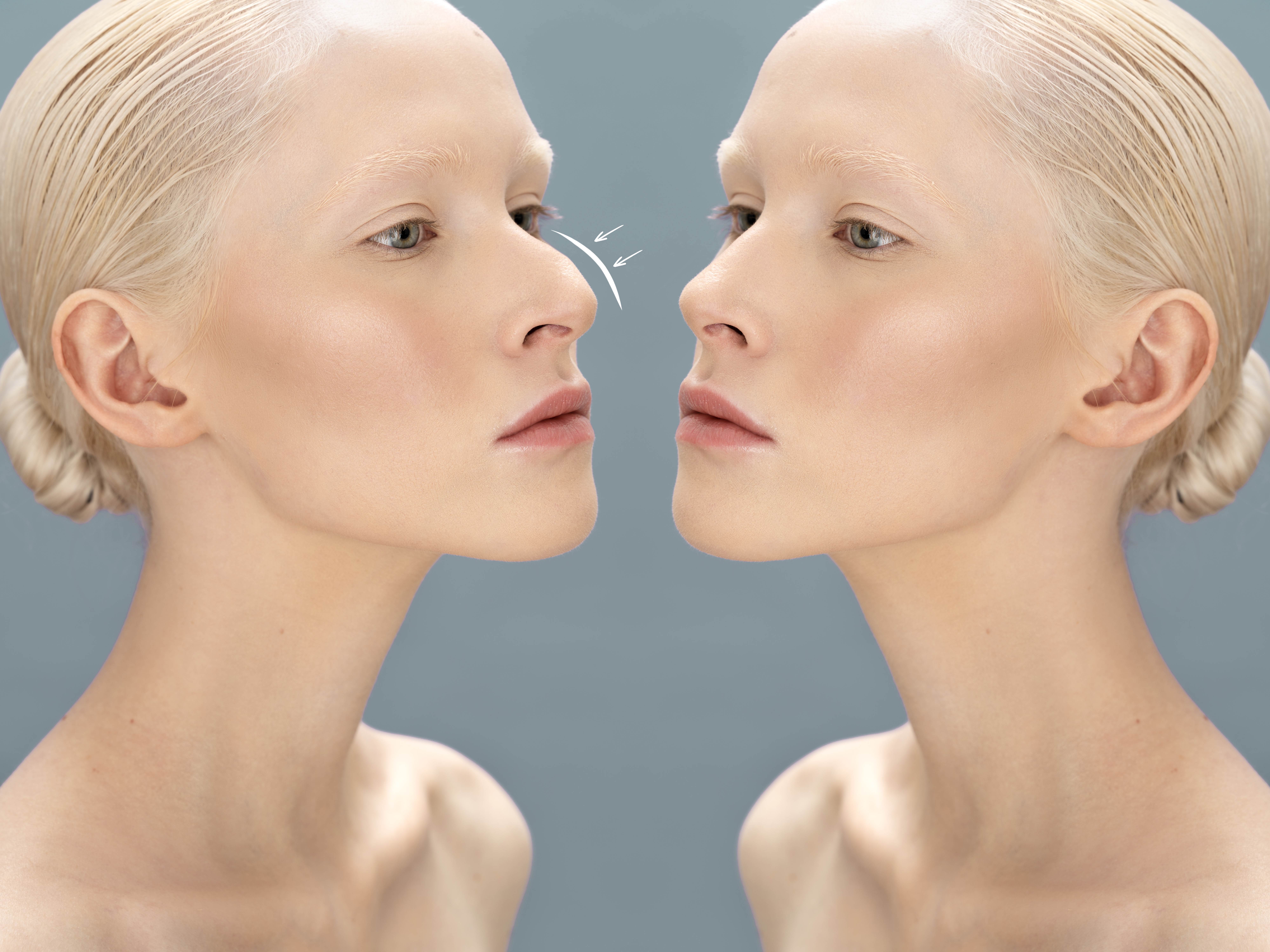 The Art of the Profile: What to Expect from a Modern Nose Job