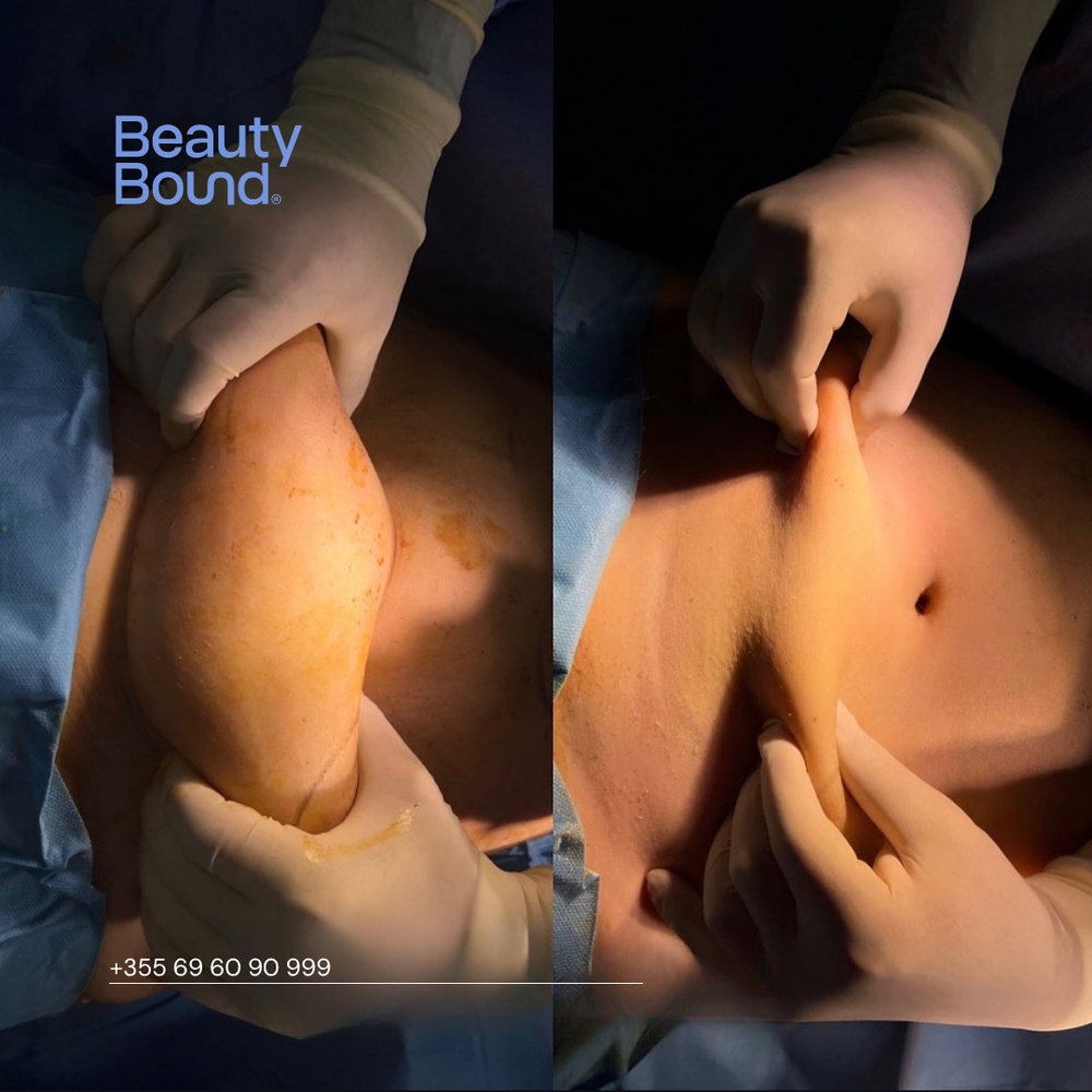 Clinic Results Gallery