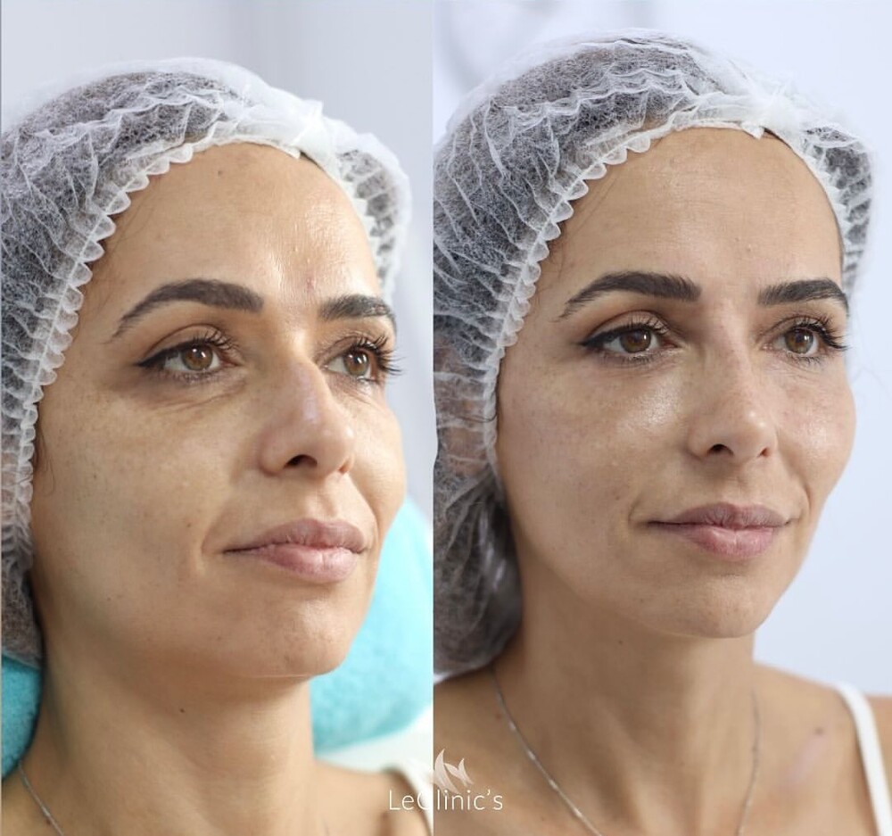 Clinic Results Gallery