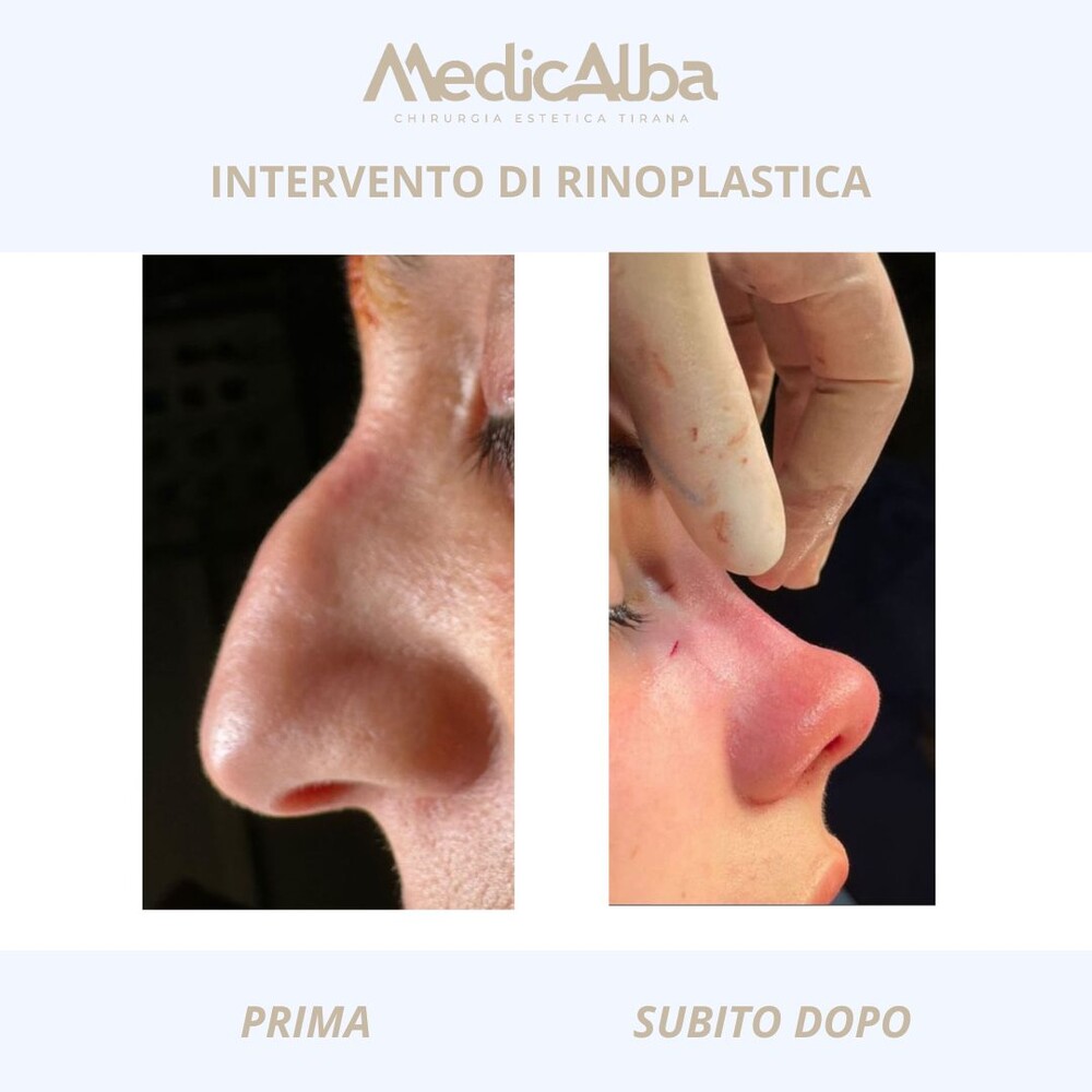 Clinic Results Gallery